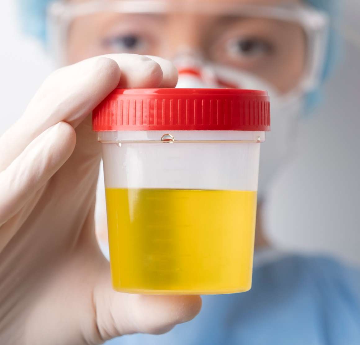 Per quanto tempo il CBD è rilevabile nelle urine?